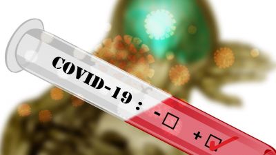 141 ezer embert teszteltek le a hétvégén Szlovákiában, jön az országos tesztelés