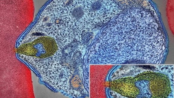 2050-re teljesen eltűnhetne a malária a Földről